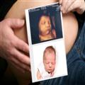 0aea97ab_3d-4d-sonography