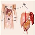 4c1ed699_spleen