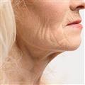 b4f9927a_neck-aging