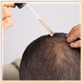 ba910fad_hair-regrow