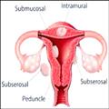 bf96b21f_infertility1
