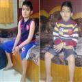 cd9bba69_Muscular-Dystrophy-2